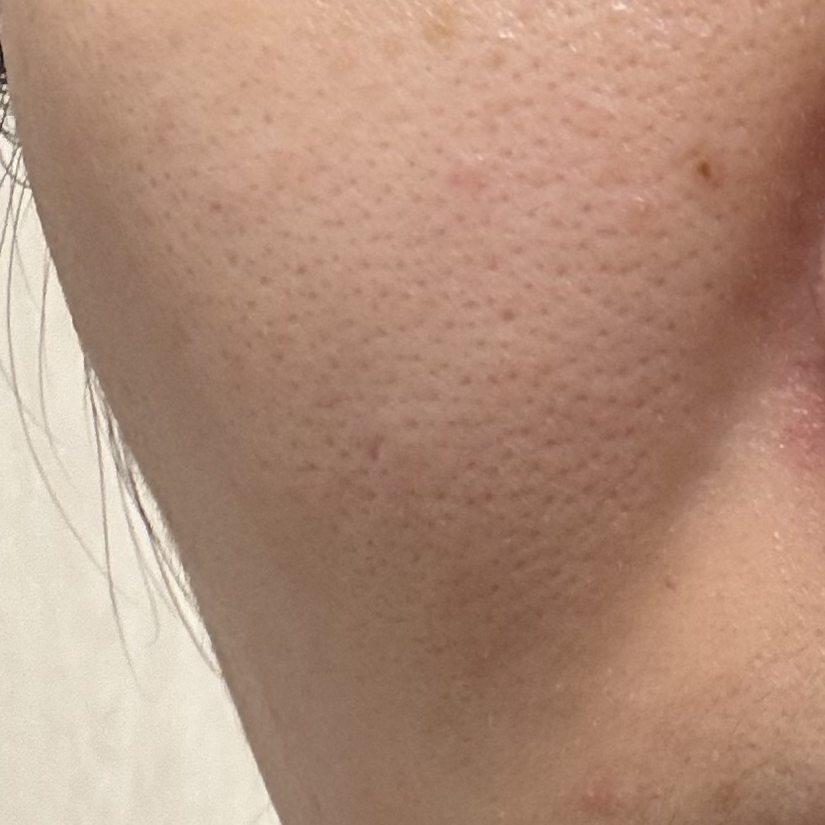 마미케어 (mommycare) 바다포도 레티놀 모공앰플 review image