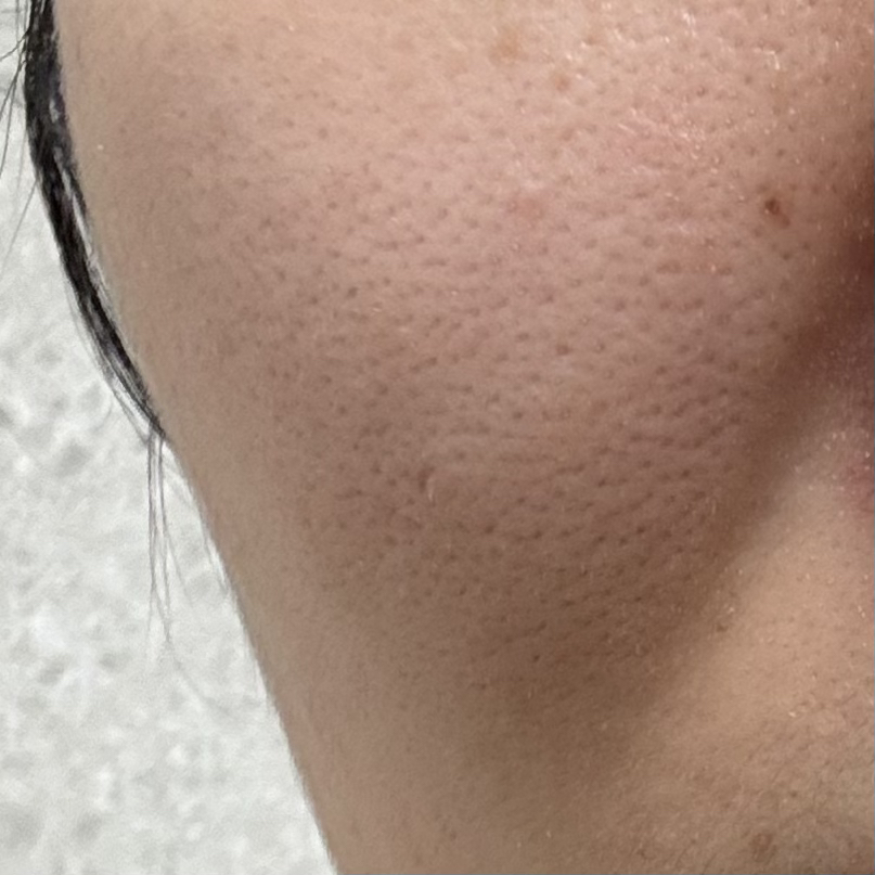 마미케어 (mommycare) 바다포도 레티놀 모공앰플 review image