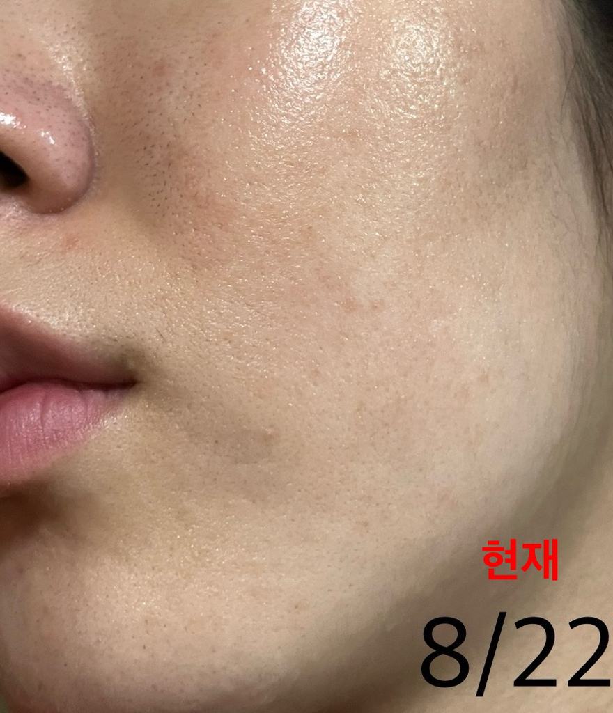 아누아 (Anua) 3 세라마이드 판테놀 모이스처 베리어 크림 review image