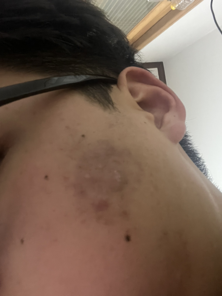 海德拉生物调理水的真实用户使用照片