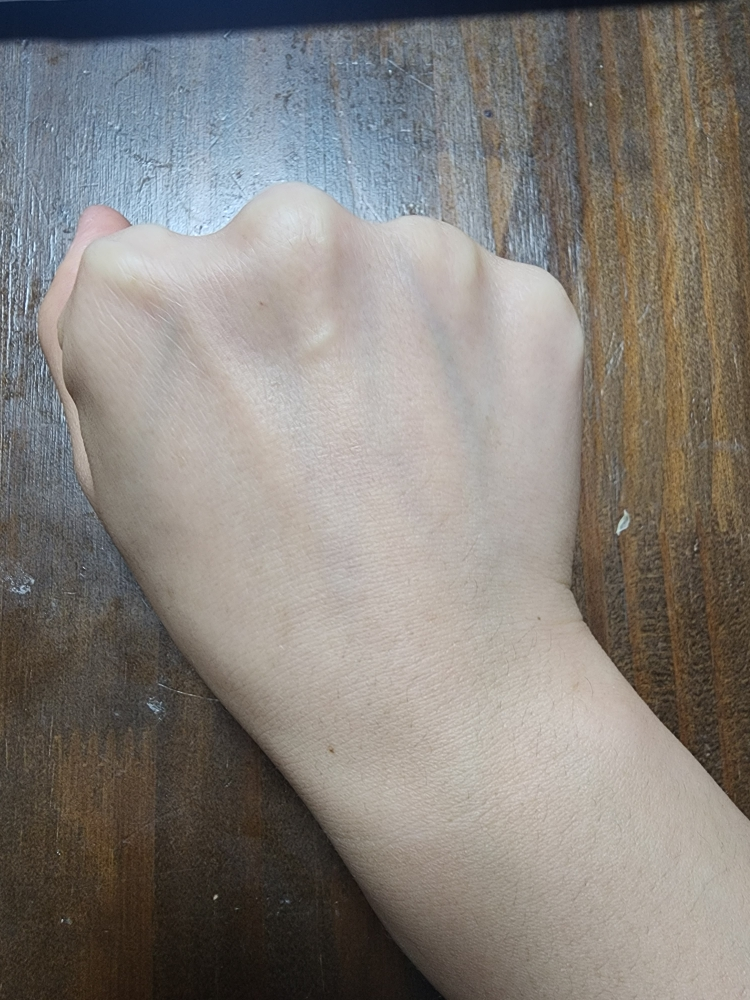 阿托贝瑞365乳液的真实用户使用照片