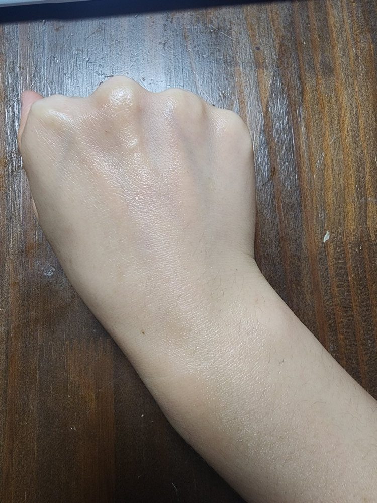 阿托贝瑞365乳液的真实用户使用照片