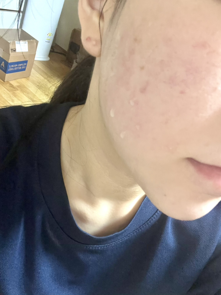 嫩艾蒿洁面吸附泡沫的真实用户使用照片