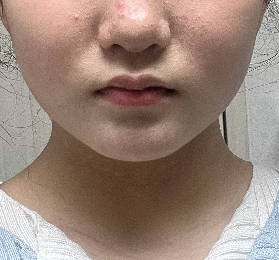 아크네스 (Acnes) 클리어 앤 화이트 포밍워시 review image