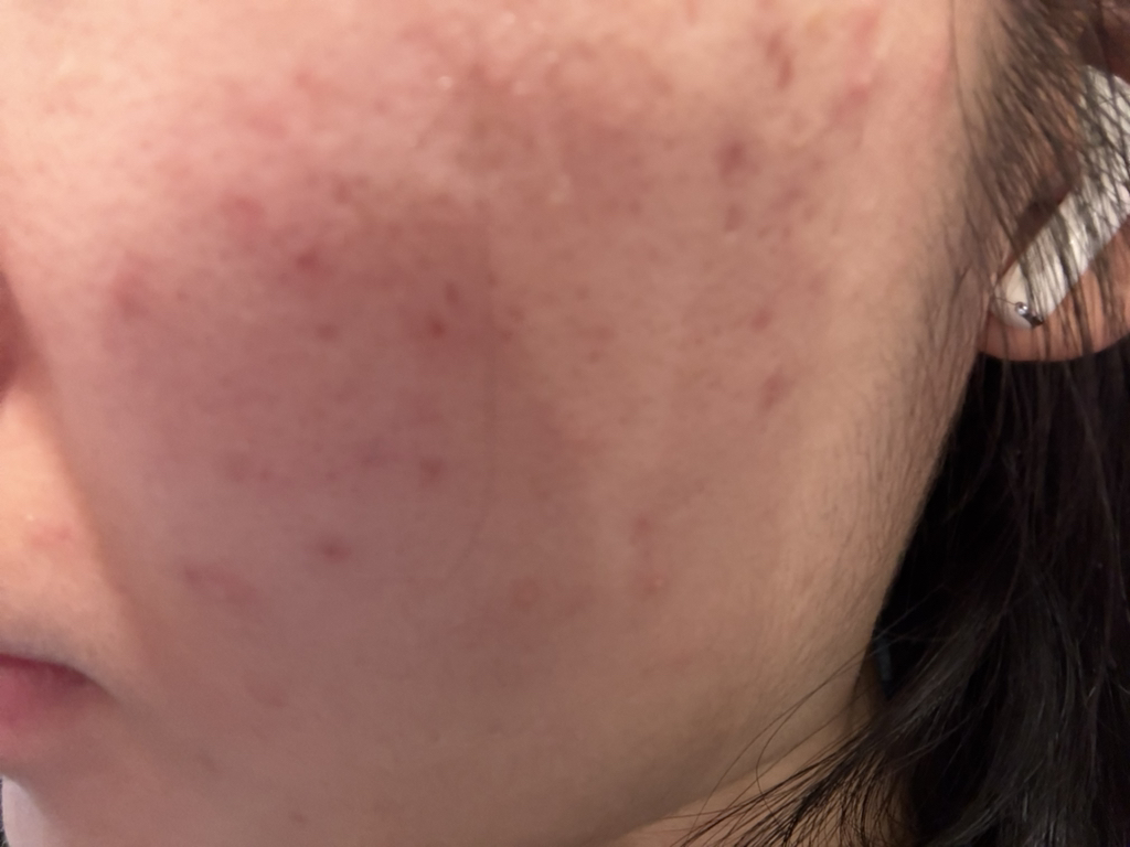 AESTURA 特拉克尼365活性精华液 common.review image
