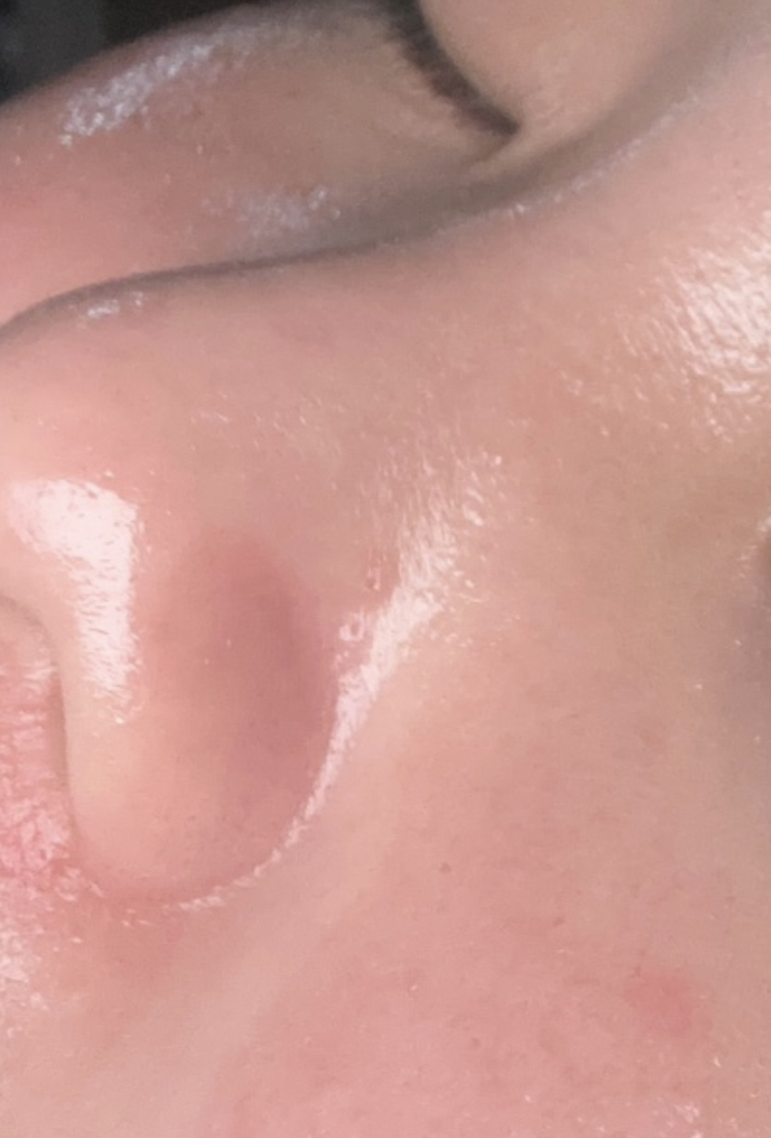 胶原蛋白深层面膜的真实用户使用照片