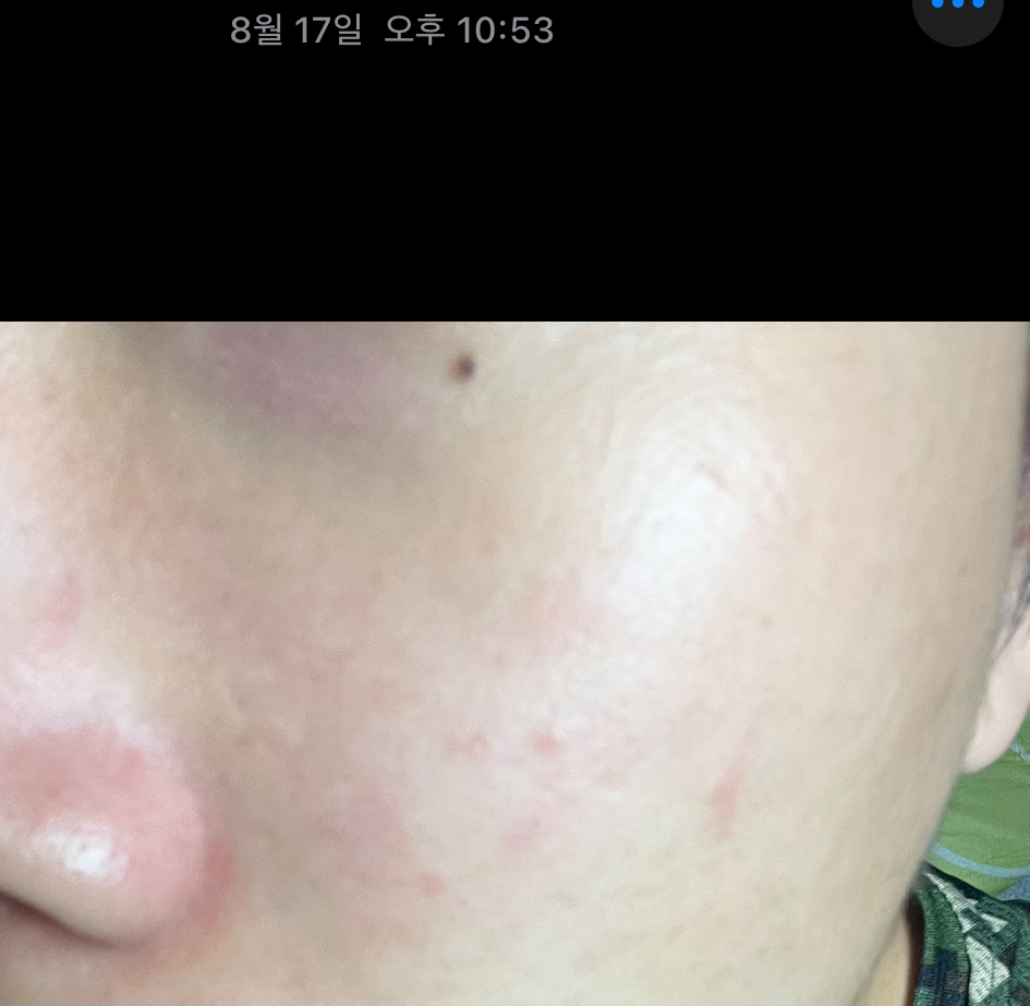 나노레시피 (NANORECIPE) EGF 1ppm 원액 review image