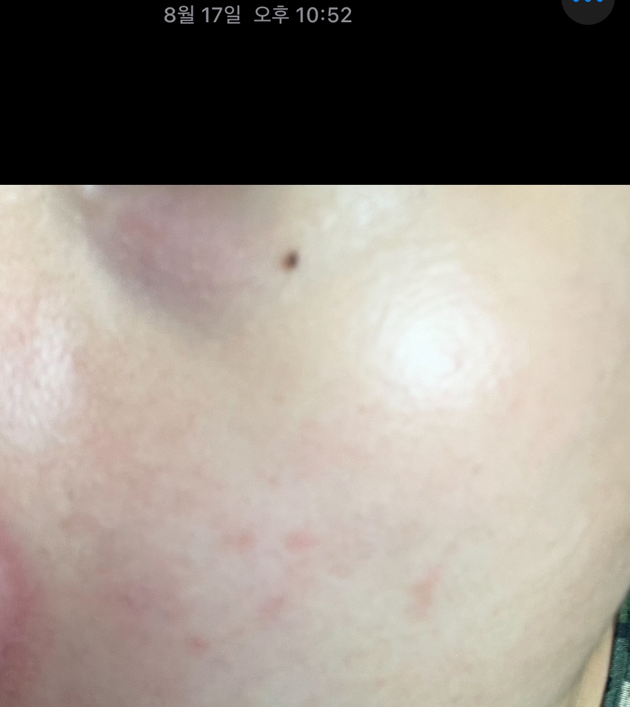 나노레시피 (NANORECIPE) EGF 1ppm 원액 review image