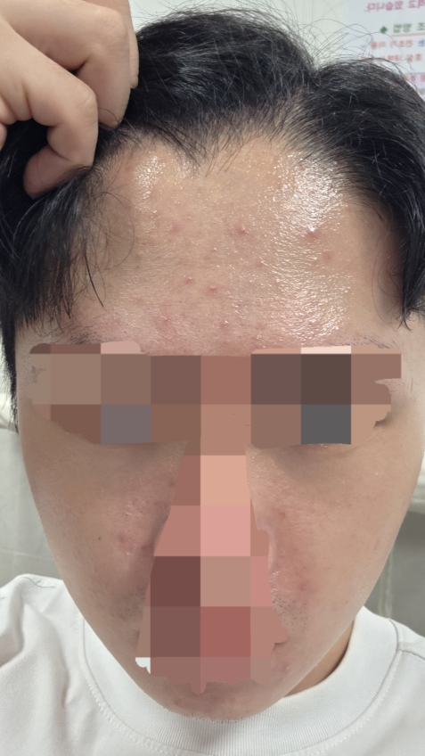 感光素皮肤霜的真实用户使用照片