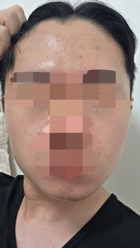感光素皮肤霜的真实用户使用照片