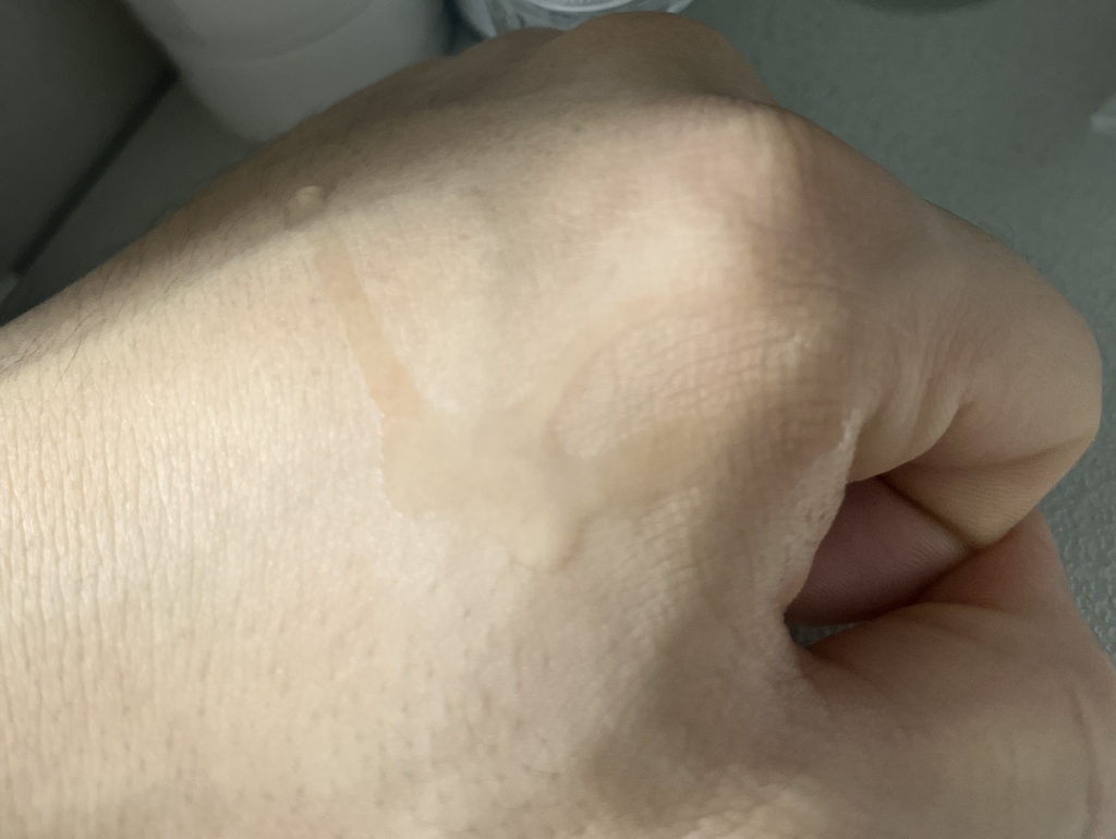 真正玻尿酸100爽肤水的真实用户使用照片