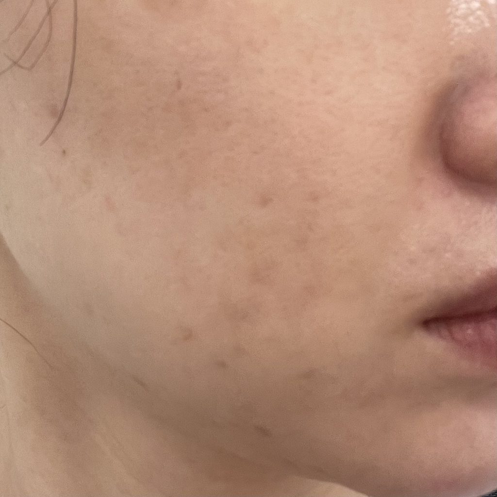皇家分层泡沫爽肤水的真实用户使用照片