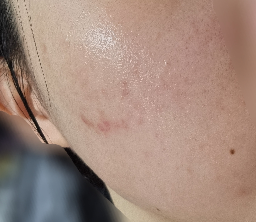 아이소이 (ISOI) 블레미쉬 케어 업 세럼 review image