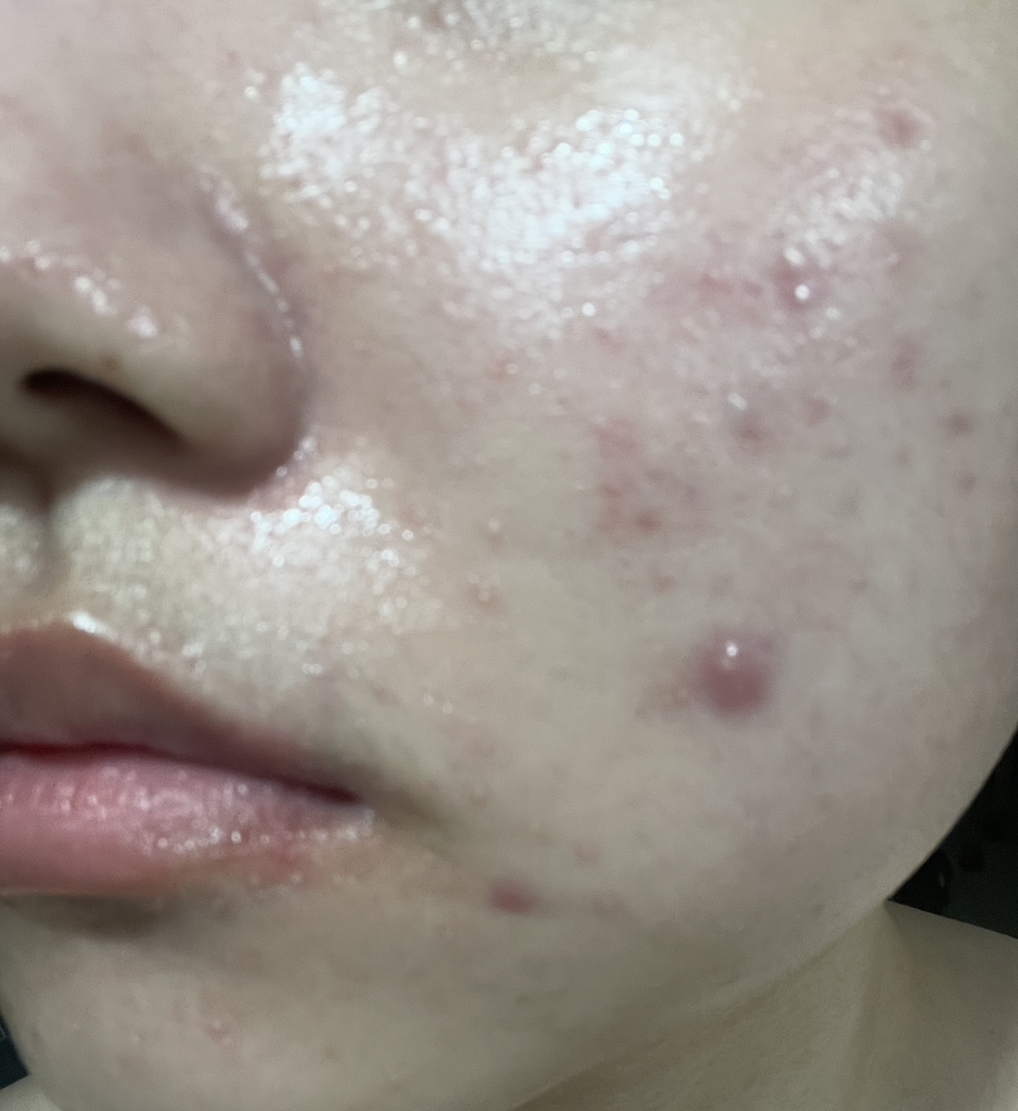 遮瑕修颜气垫 AD [SPF35/PA++] [A02]的真实用户使用照片