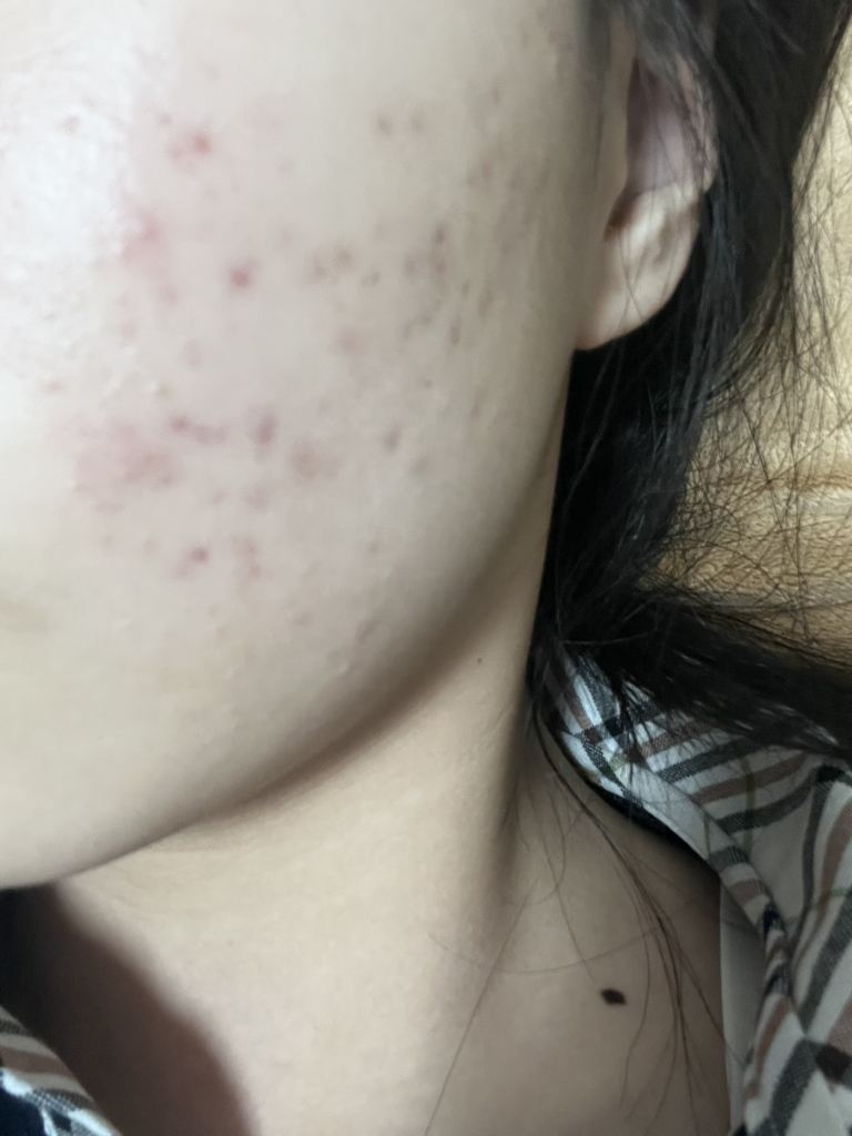 메디큐브 (medicube) 레드 이레이징 크림 2.0 review image