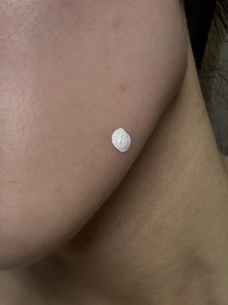 马蹄莲卡尔明镇静膏点的真实用户使用照片