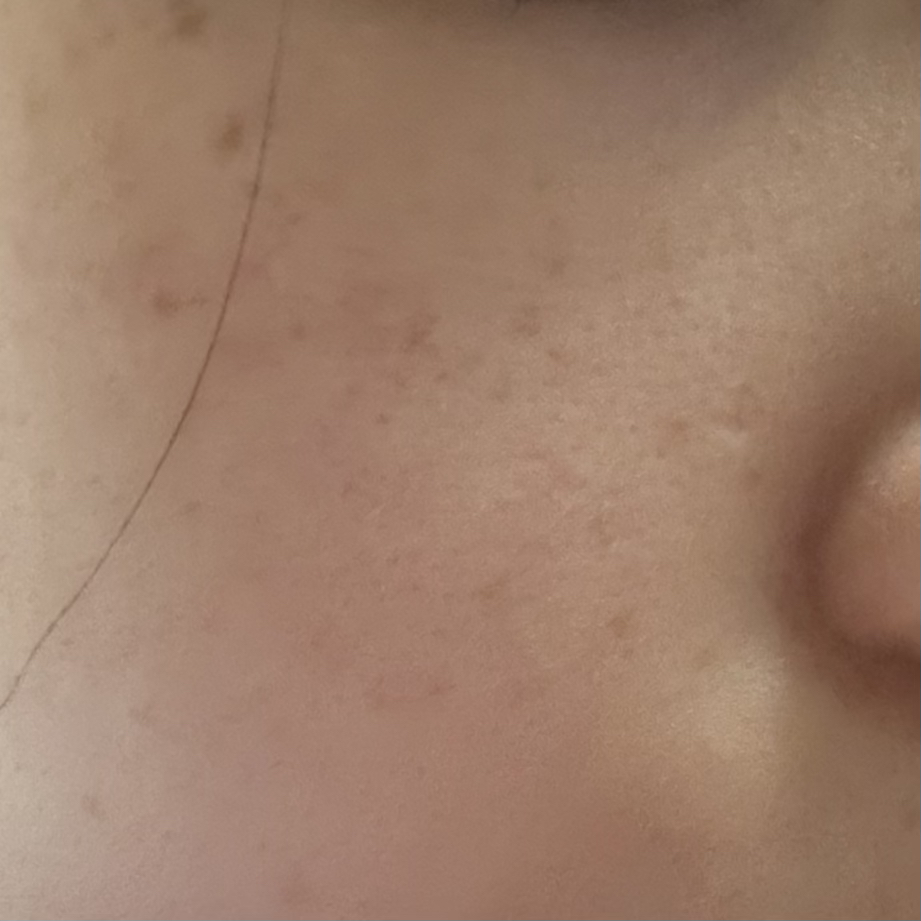 로포에 (LOPOE) 베러 밸런스 앰플 review image