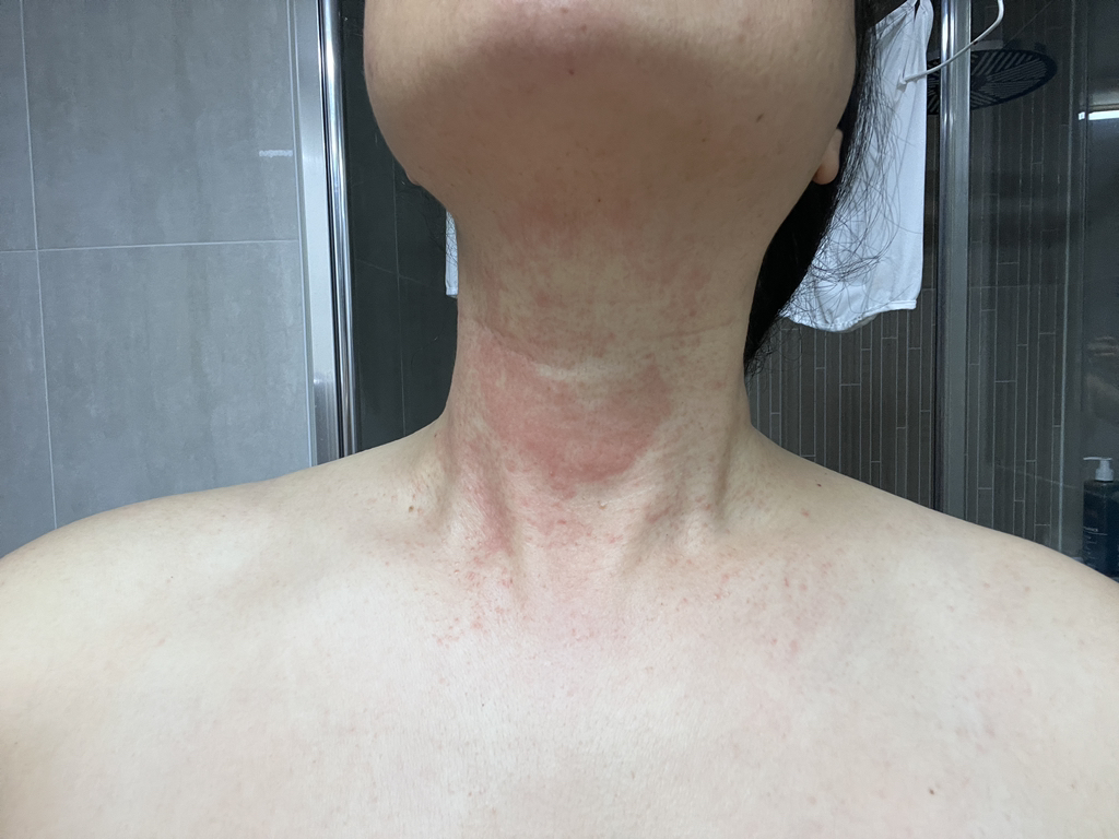 에스트라 (AESTURA) 아토베리어365 세라-히알 속수분 앰플 review image