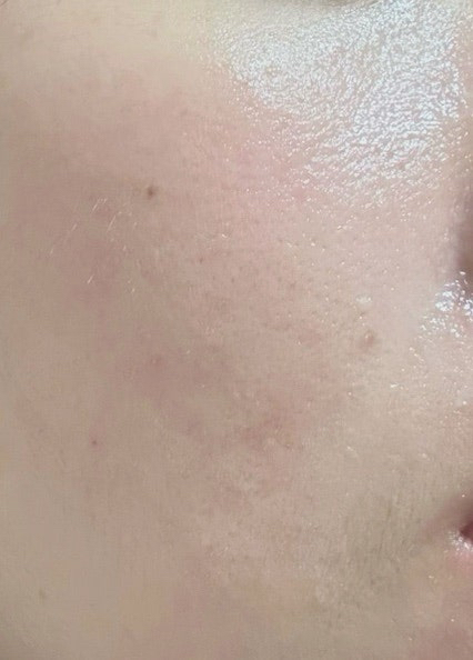디어글램 (DEARGLAM) 글루타치온 리포좀 12.5 유리알 광채 크림 review image