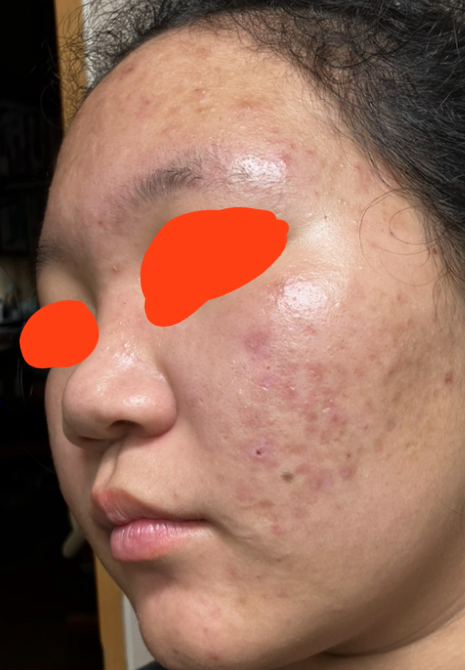 더마토리 (DERMATORY) 시카 엑소좀 흔적 진정 거즈패드 review image