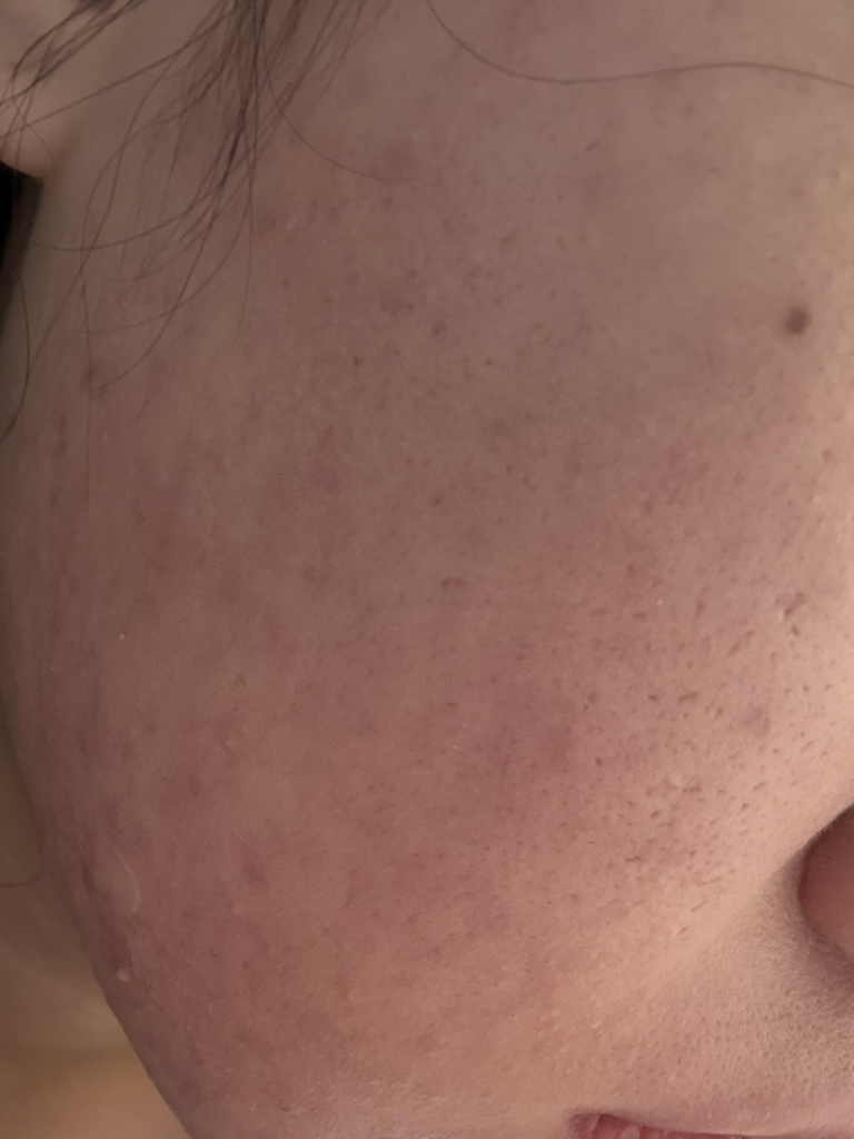 더마픽스 (DERMAFiX) 퍼펙트 리얼 퍼포먼스 [비타콜라겐] review image