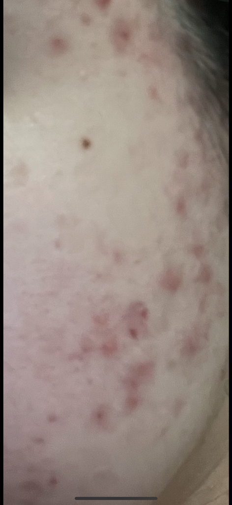 Acnes 泡沫洗涤剂 common.review image