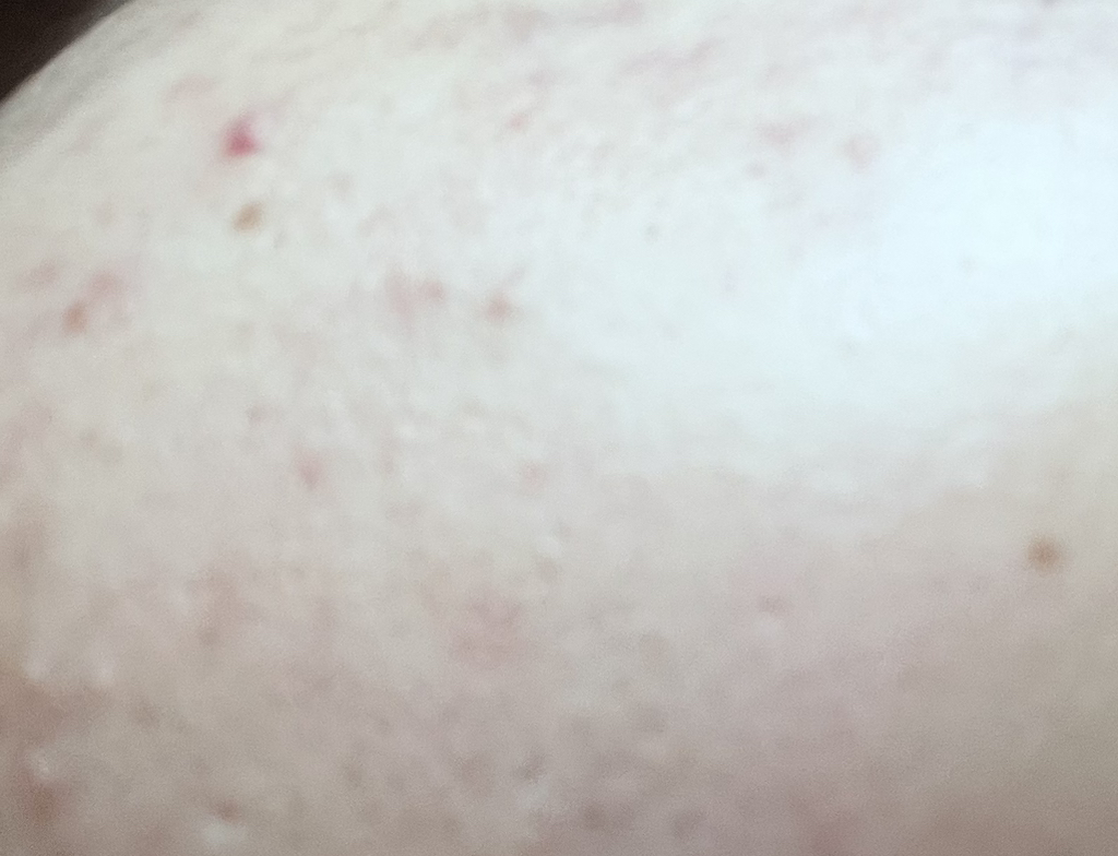 Acnes 泡沫洗涤剂 common.review image