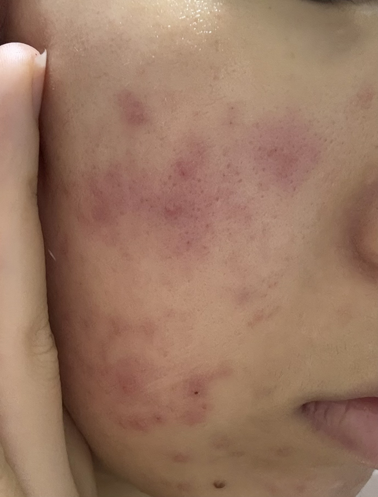 더마펌 (DERMAFIRM) 펩트올로지 부스팅 앰플 레티노이드 review image