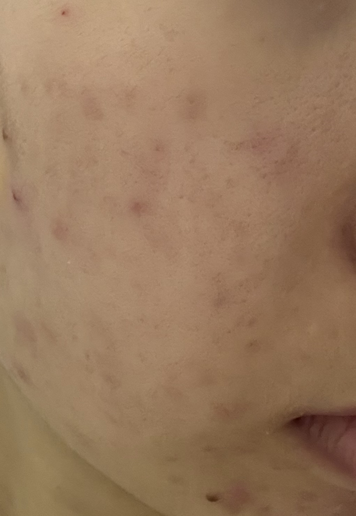 더마펌 (DERMAFIRM) 펩트올로지 부스팅 앰플 레티노이드 review image