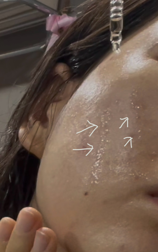 앰플엔 (AMPLE:N) 아크네샷 앰플 review image