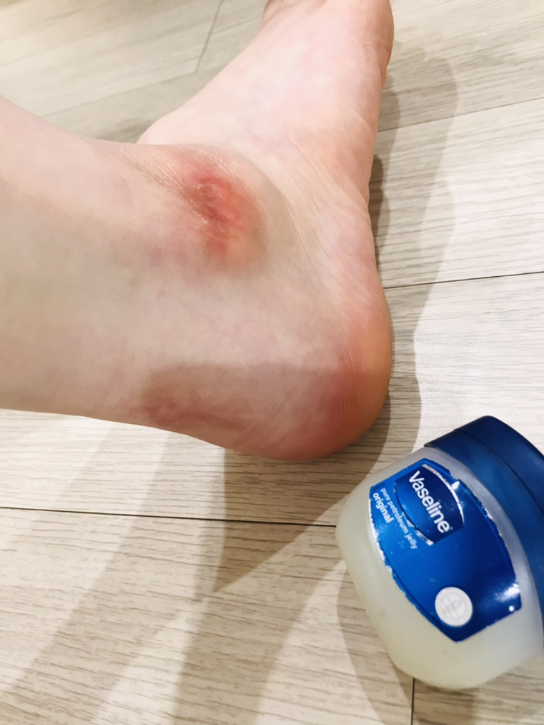 바세린 (Vaseline) (유니레버) 오리지널 프로텍팅 젤리 review image