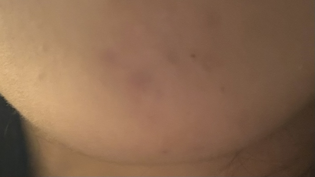 镇静护肤水 蓝色印记补水安瓶的真实用户使用照片