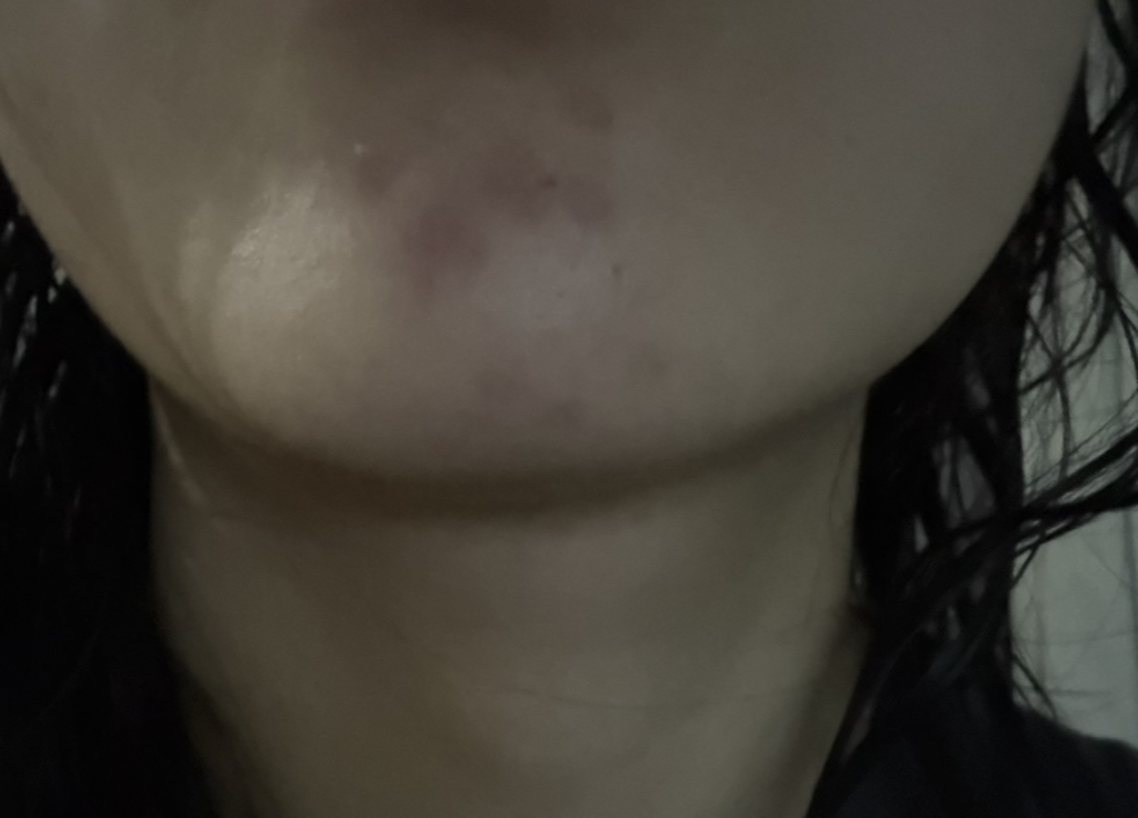 镇静护肤水 蓝色印记补水安瓶的真实用户使用照片
