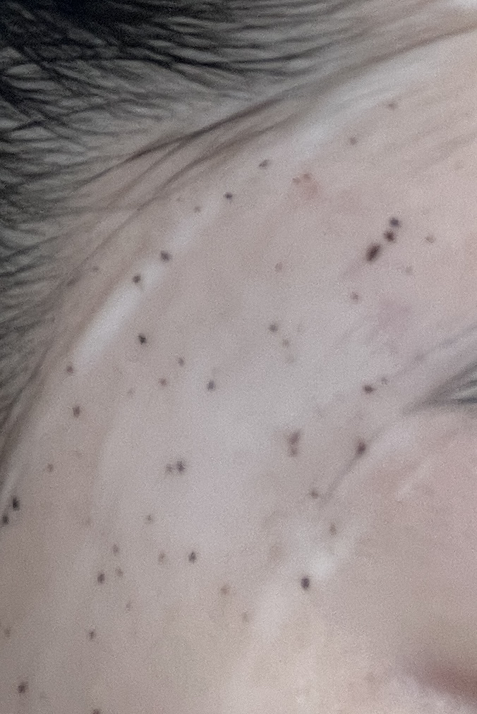 메디필 (MEDIPEEL) 시카 쿨링 진정 랩핑 마스크 review image