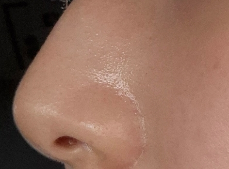 天然温和清洁鼻膜的真实用户使用照片