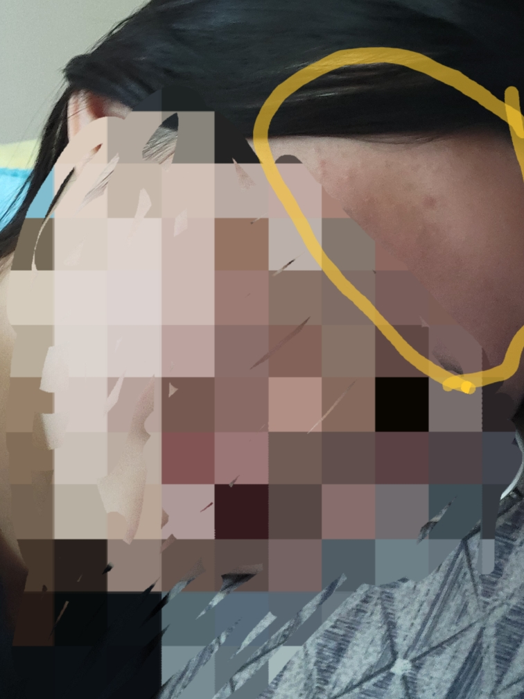 黄芩草泰卡胶囊精华镇静滴剂的真实用户使用照片