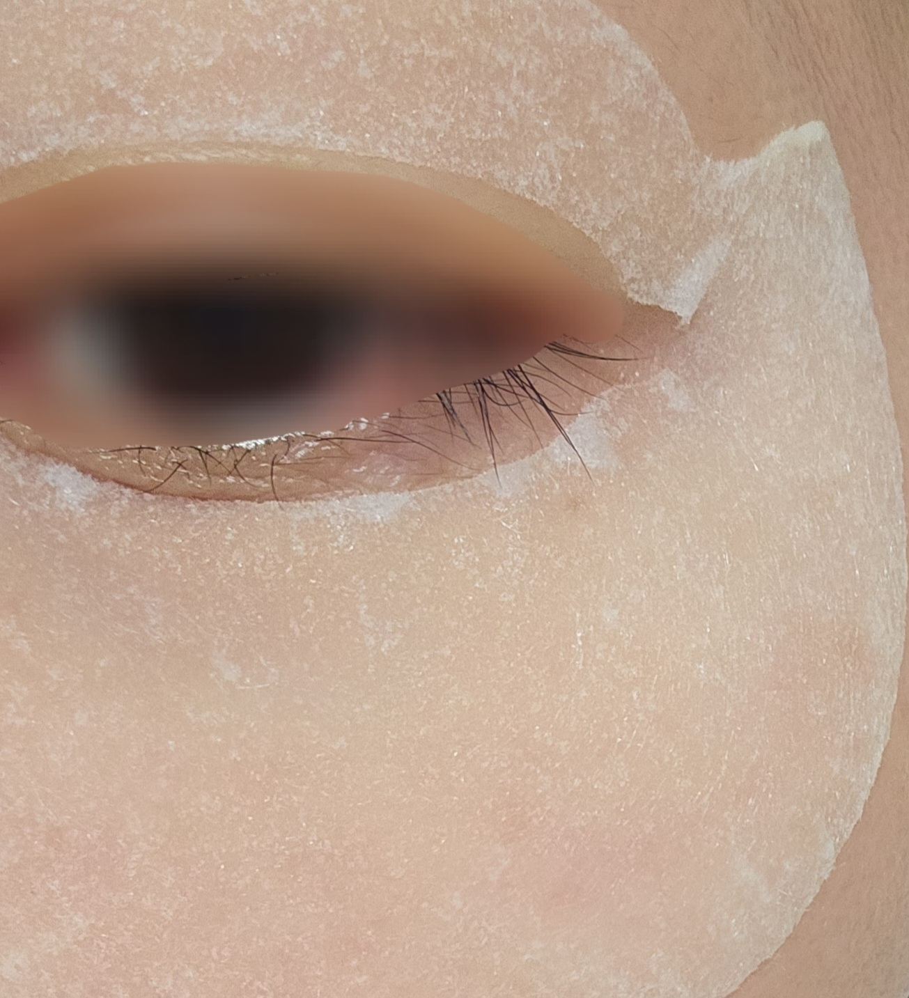 소미썸 (SOMISOME) 젤리 아이 패치 [주름] review image