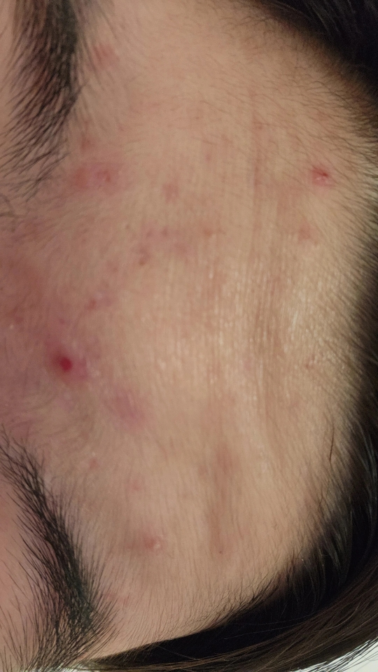 아크네스 (Acnes) 퍼펙트 솔루션 폼클렌저 review image