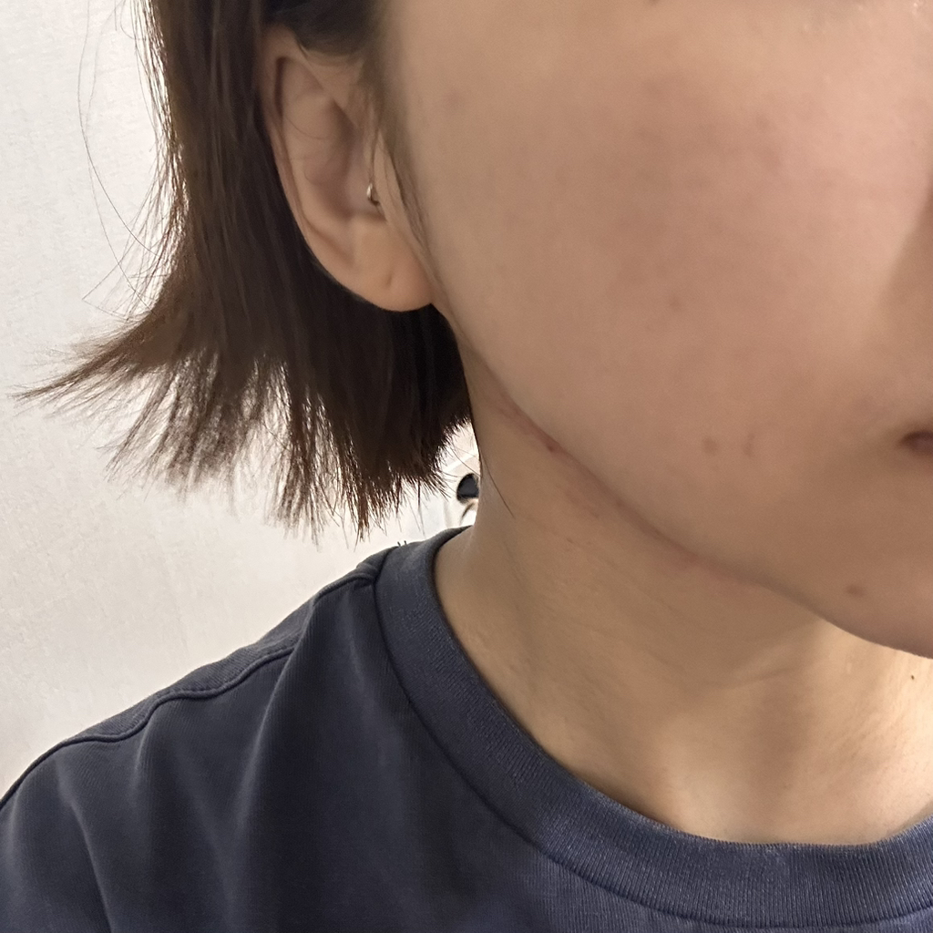 Vegreen 无香味西柯精华液 common.review image