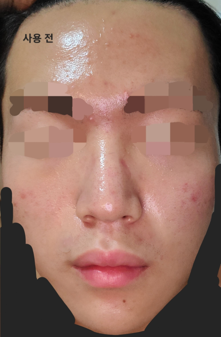 닥터트웬티프로젝트 (Dr.twentyproject) 나인 토너 review image