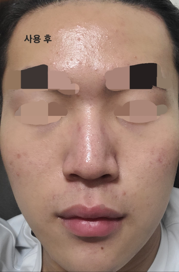 닥터트웬티프로젝트 (Dr.twentyproject) 나인 토너 review image