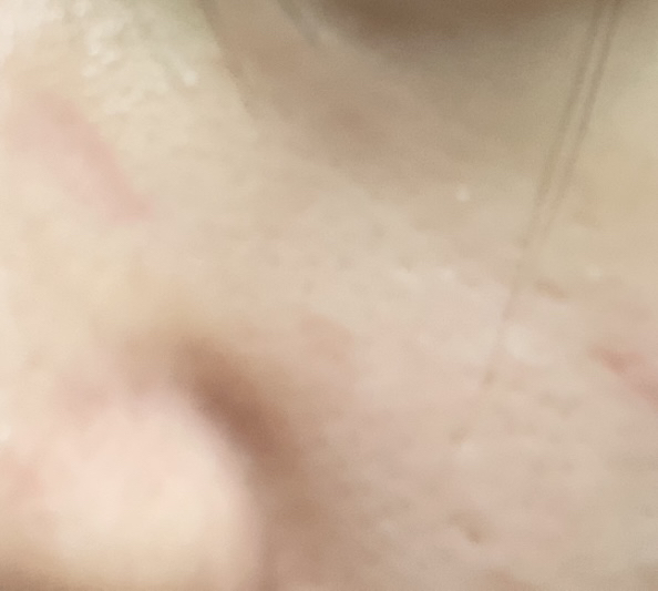 PDRN Specular 毛孔紧致安瓶的真实用户使用照片