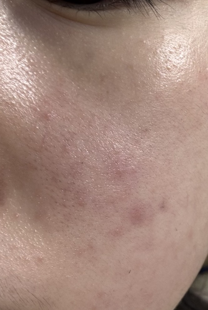 AC 深层追踪镇静安瓶的真实用户使用照片