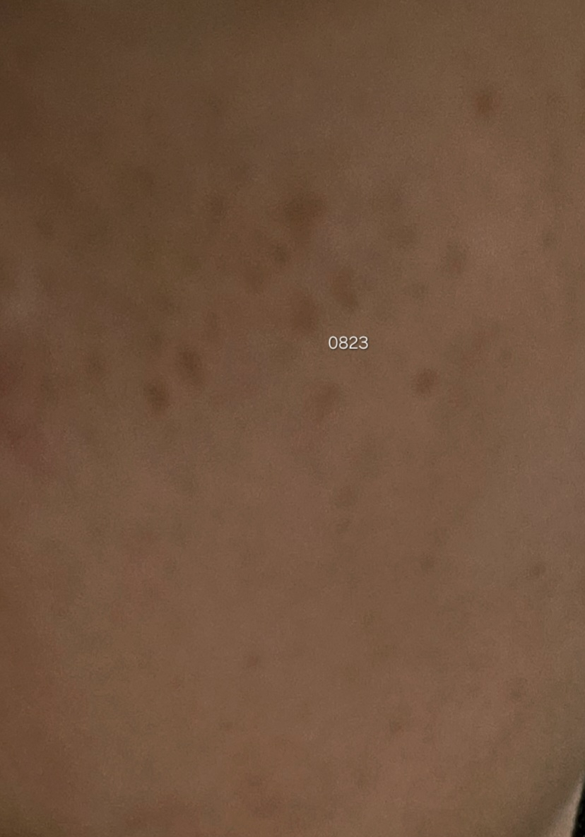 더멜라 (Dermela) 루미샷 더블 비타 스피큘 부스터 세럼 review image