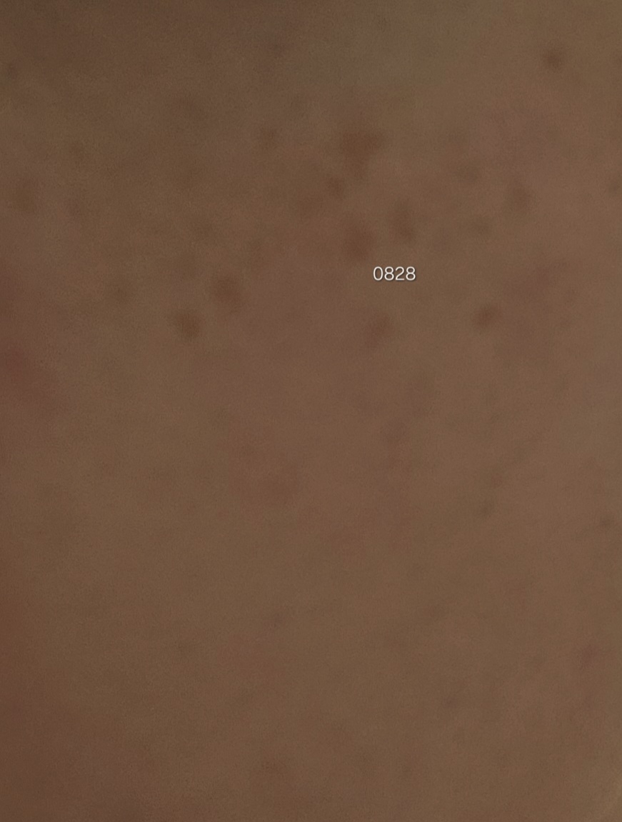 더멜라 (Dermela) 루미샷 더블 비타 스피큘 부스터 세럼 review image