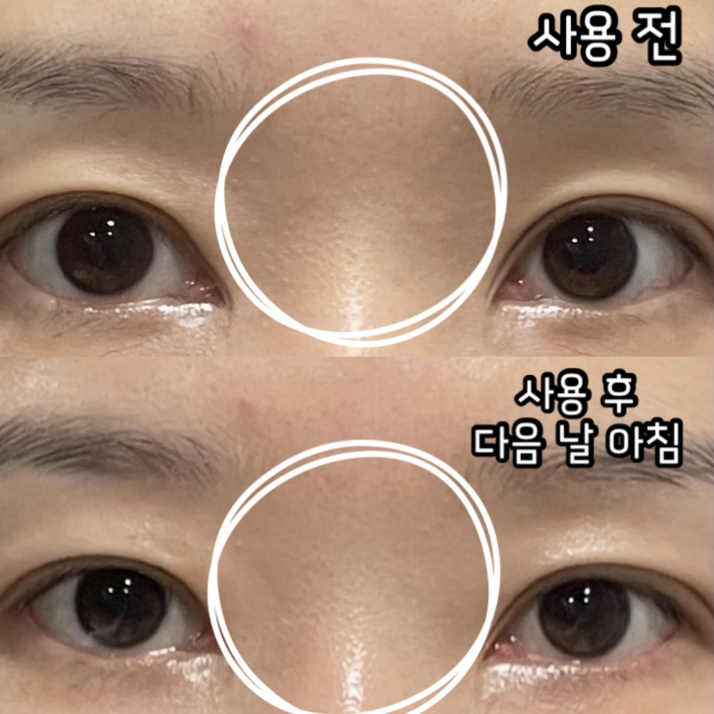 프리메라 (primera) 유스 래디언스 비타티놀 세럼 review image