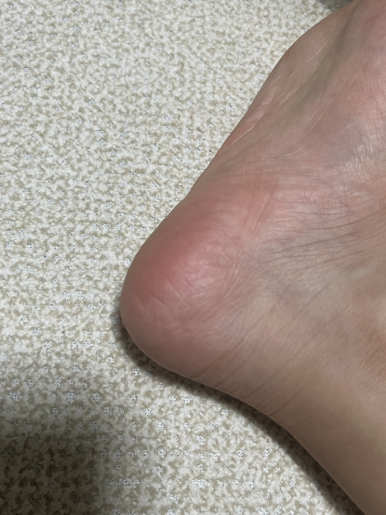 메디필 (MEDIPEEL) EGF 스케일링 모이스처 풋 크림 review image