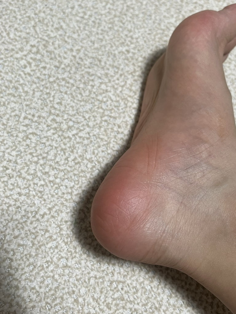 메디필 (MEDIPEEL) EGF 스케일링 모이스처 풋 크림 review image