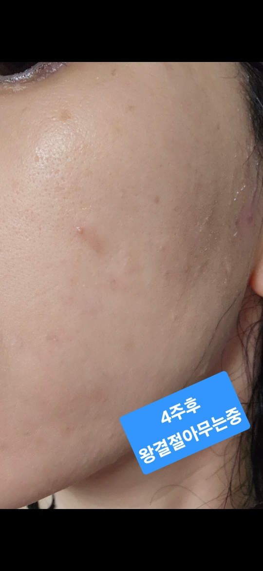 코스알엑스 (COSRX) 더 나이아신아마이드 15 세럼 review image