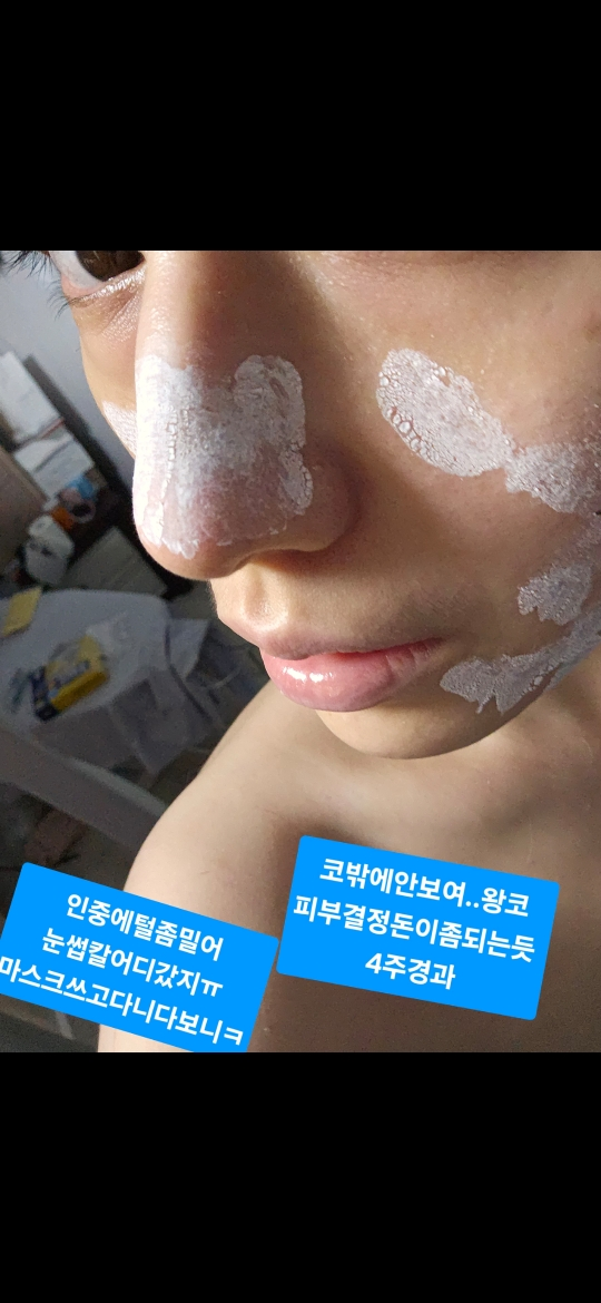 코스알엑스 (COSRX) 더 나이아신아마이드 15 세럼 review image